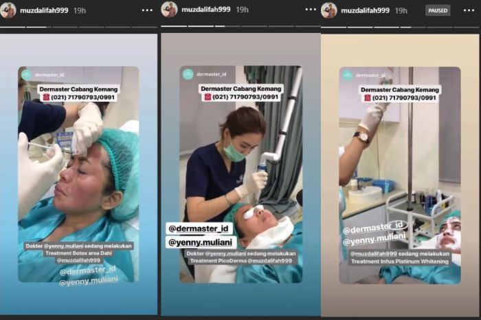 Muzdalifah sedang lakukan perawatan suntik botox