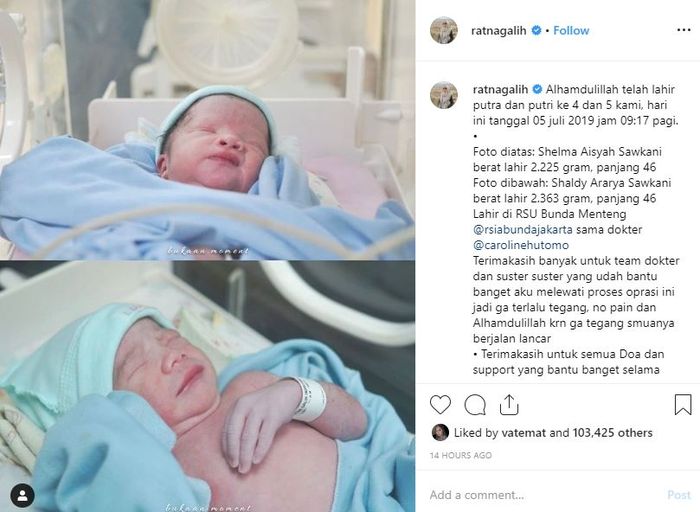 Bayi kembar dampit Ratna Galih