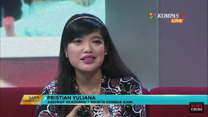 Kembar siam Yuliana yang kini menjadi asisten profesor