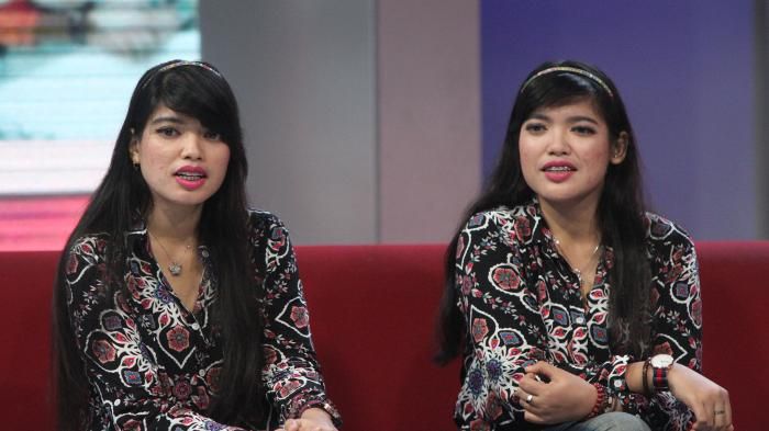 Tribunnwes.com
Kembar siam Yuliana Yuliani