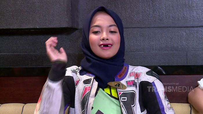 Inilah kondisi Kintan Mary sekarang, giginya telah ompong empat buah.