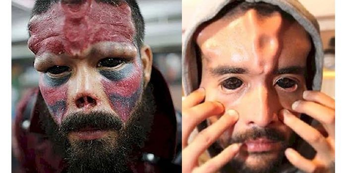 Wajah Henry saat sudah dioperasi