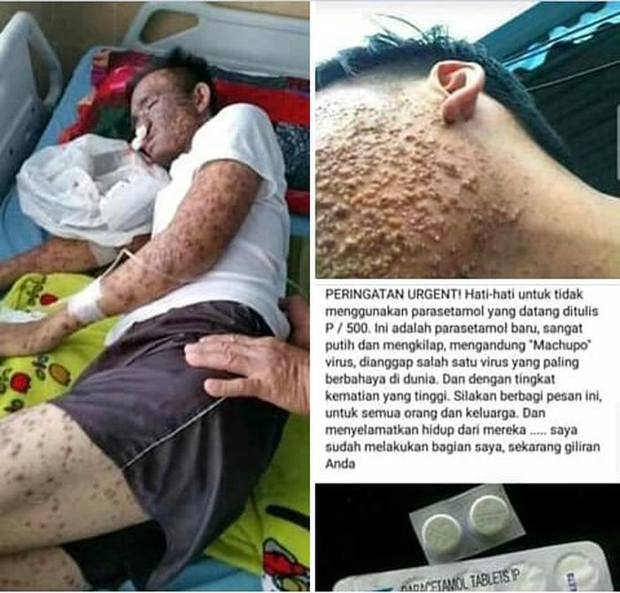 Â
Facebook
Heboh virus Machupo dalam paracetamol