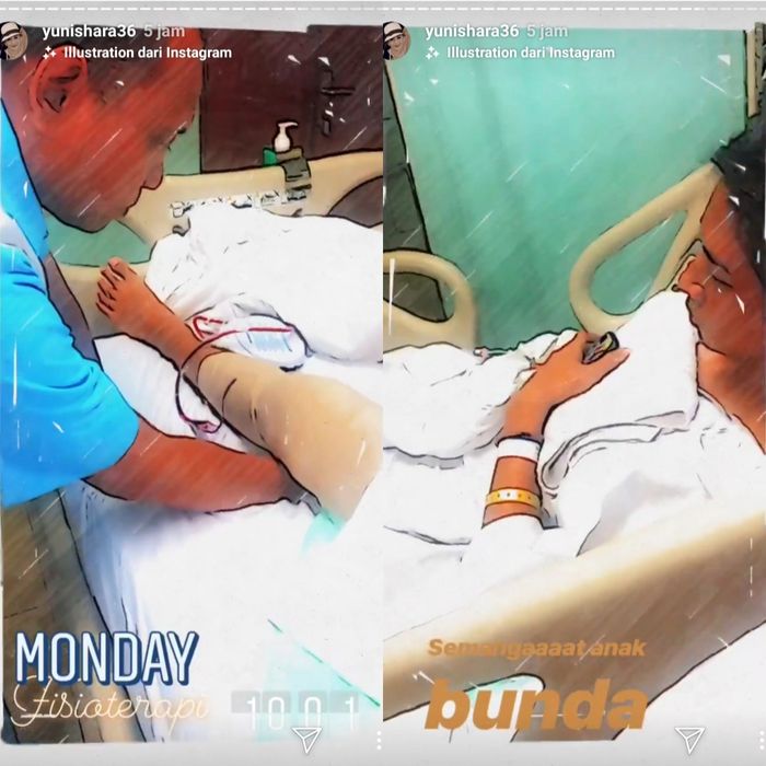 Anak Yuni Shara ditangani fisioterapi