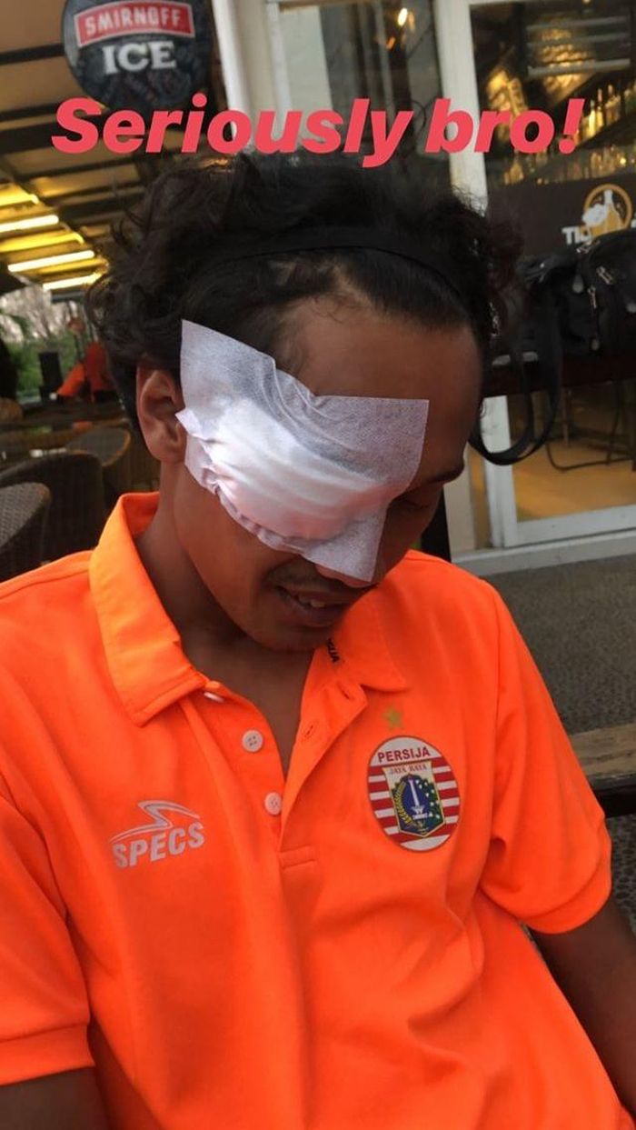 Masseure Persija Jakarta, Aditya Julistyawan, menjadi korban pecahnya kaca bus di Makassar.