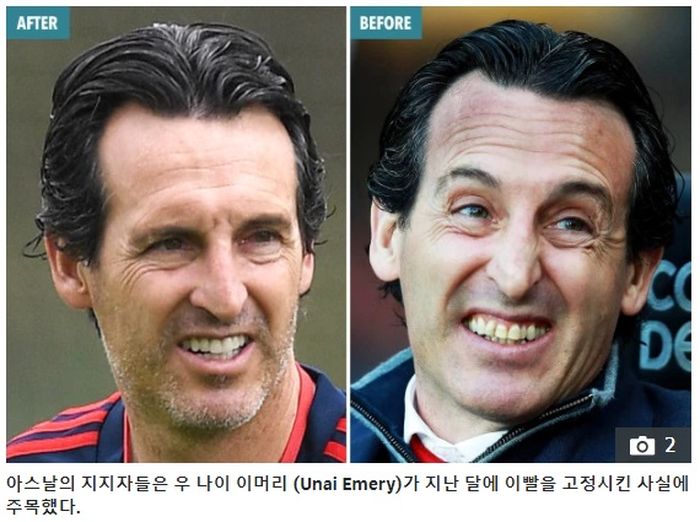 Unai Emery after and before