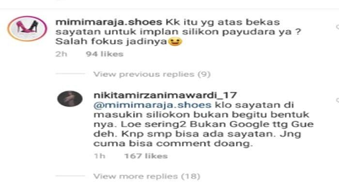 respons Nikita Mirzani saat dibilang implan payudara