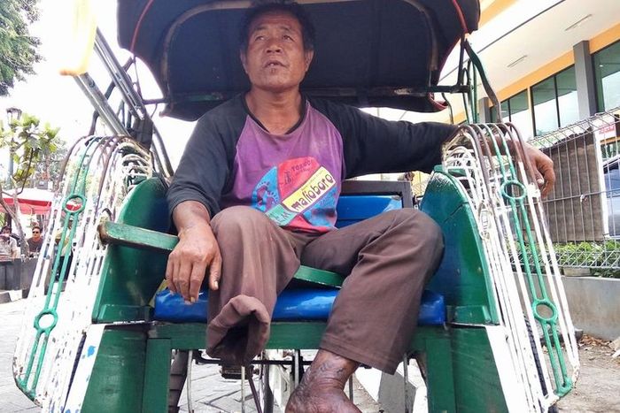 Wawan Setiawan, kayuh becak dengan satu kaki demi hidupi anak istri