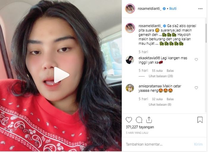 Rosa Meldianti saat mengaku baru saja melakukan  operasi pita suara. 