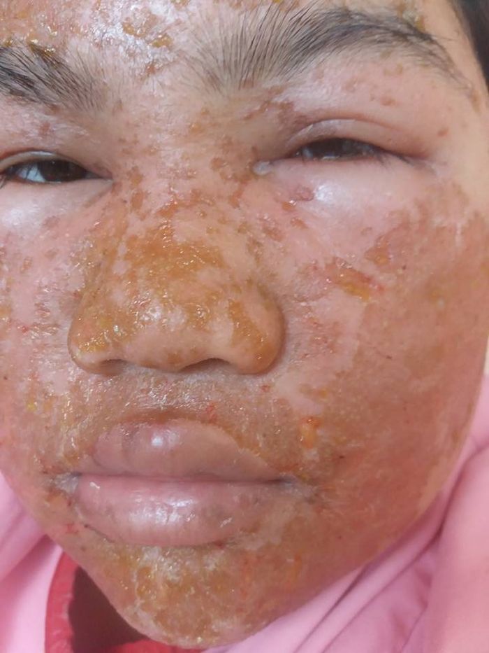 Menyusui Boleh Pakai Krim Pemutih Wajah Ibudanbalita Net Menyusui Boleh Pakai Krim Pemutih Wajah Ibudanbalita Net