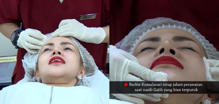 Barbie Kumalasari menjalani perawatan wajah di sebuah klinik kecantikan