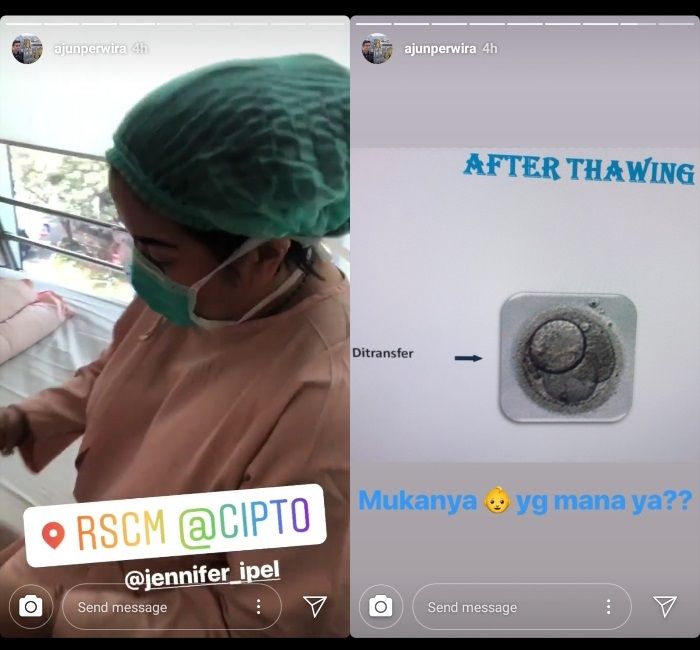 Potret Jennifer Jill saat akan menjalani transfer embrio dan hasil prosedurnya.