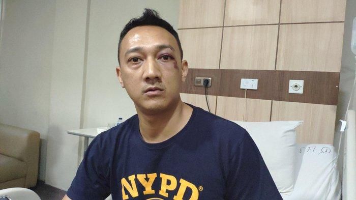 Kapolsek Patumbak AKP Ginanjar Fitriadi saat dirawat pasca dikeroyok 20 orang sindikat narkoba Medan. (Tribun Medan/M Andimaz)