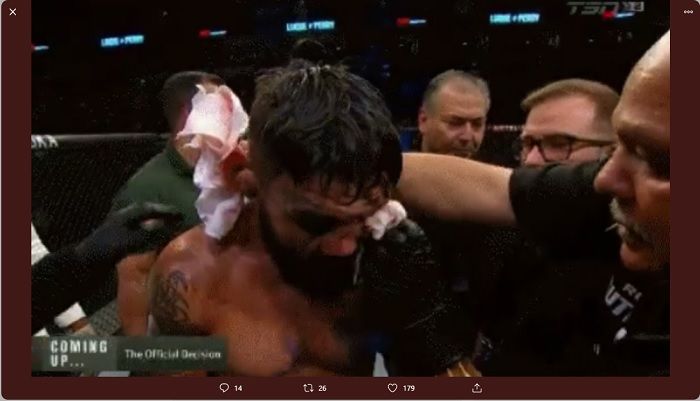 Petarung UFC Amerika Serikat, Mike Perry alami patah hidung terburuk sepanjang sejarah MMA ketika berlaga di Uruguay.