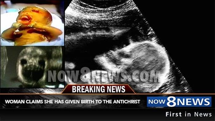 Dapat hidup di kandungan tanpa air ketuban, bayi ini malah dijuluki ibunya sebagai bayi setan