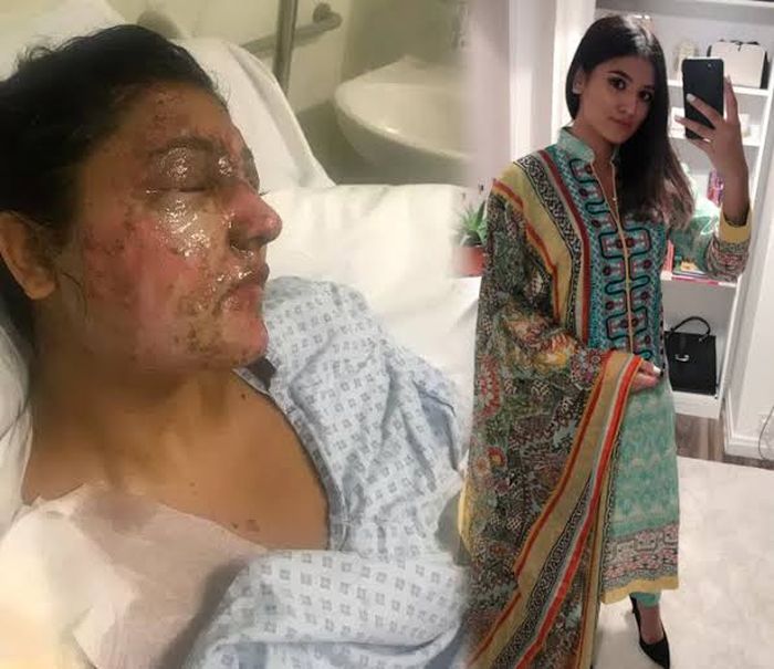 Wajah Resham Khan usai mendapat perawatan.