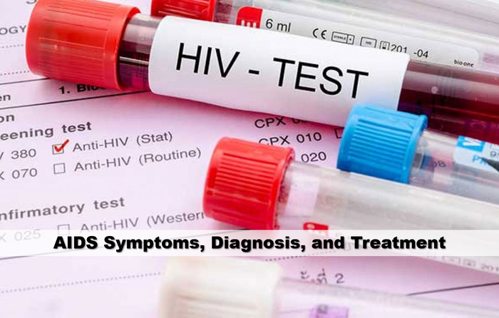 Lakukan tes <a href='https://pontianak.tribunnews.com/tag/hiv' title='HIV'>HIV</a> bila mengalami gejala-gejala tertular penyakit tersebut.