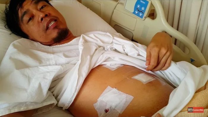 Kondisi Ian Kasela usai operasi Youtube