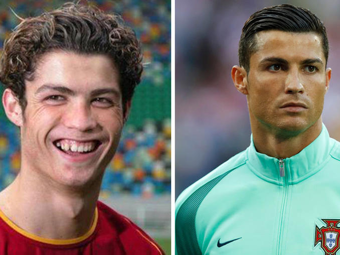 Perubahan wajah megabintang Juventus, Cristiano Ronaldo.
