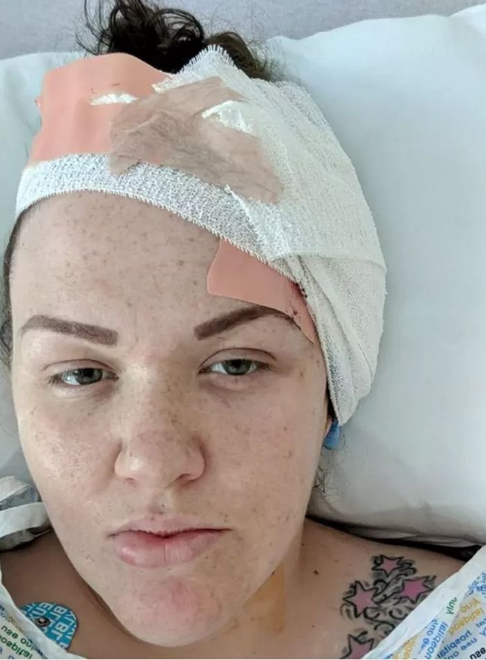 Gemma dioperasi bagian telinganya