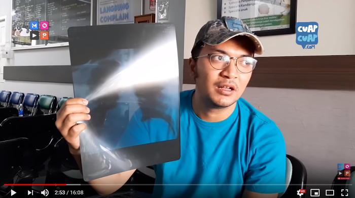 Ihsan menunjukkan hasil rontgen usai kecelakaan