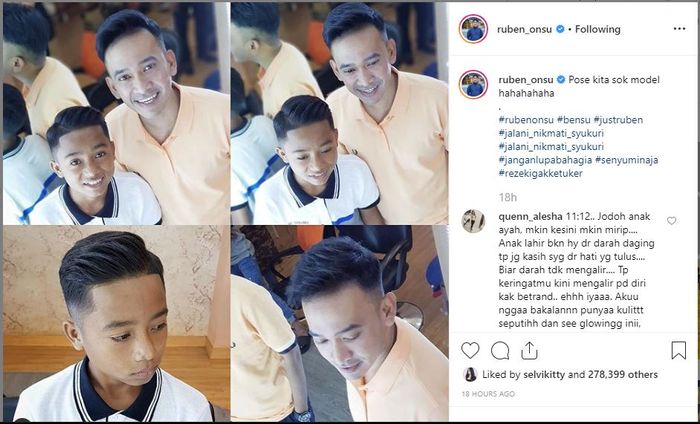 Betrand Peto dan Ruben Onsu makin mirip.