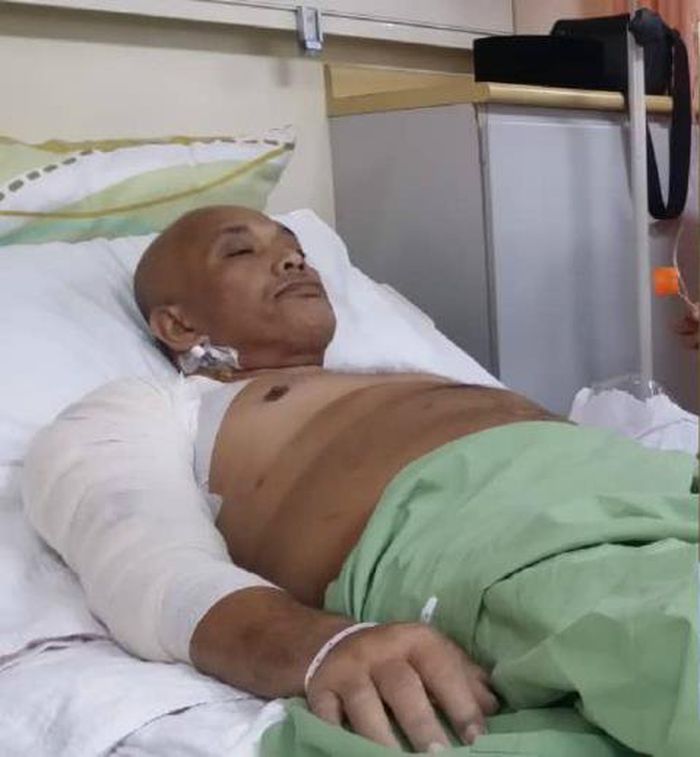 Mohd Razin usai melakukan operasi.