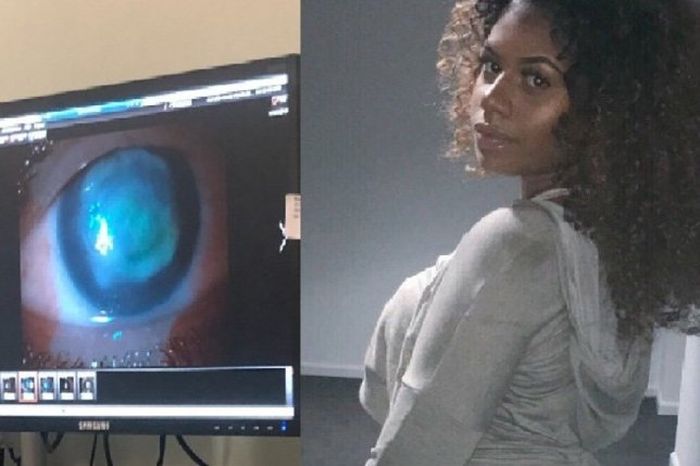 Miyako kehilangan penglihatannya setelah berenang di laut