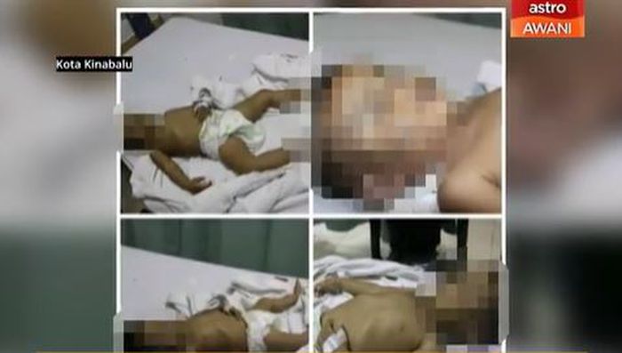 Bayi yang menjadi korban