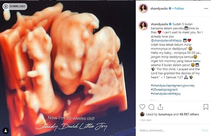 unggahan USG bayi Shandy Aulia