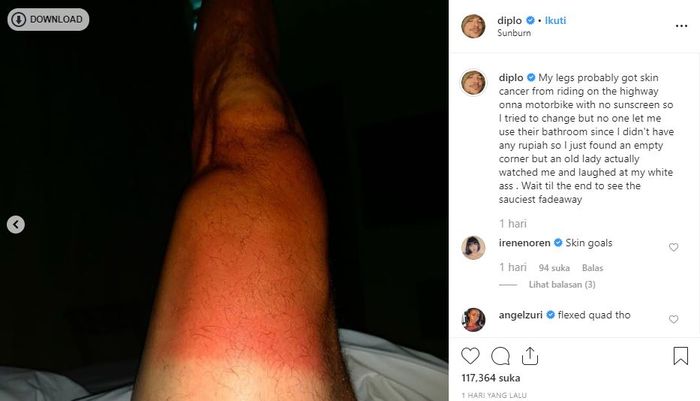 tangkap layar instagram @Diplo
Diplo menceritakan kejadian kocak saat liburan di Bali.
