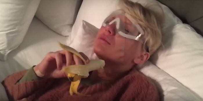 Taylor Swift usai operasi mata