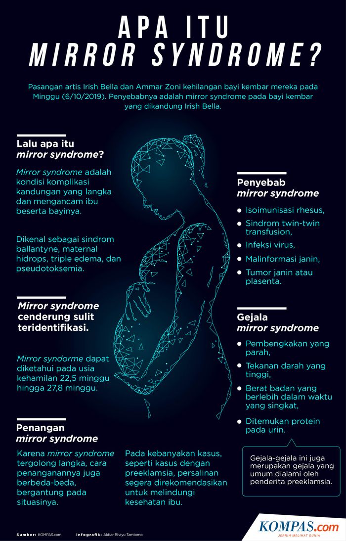 Mengenal Mirror Syndrome yang Sebabkan Irish Bella Kehilangan Calon