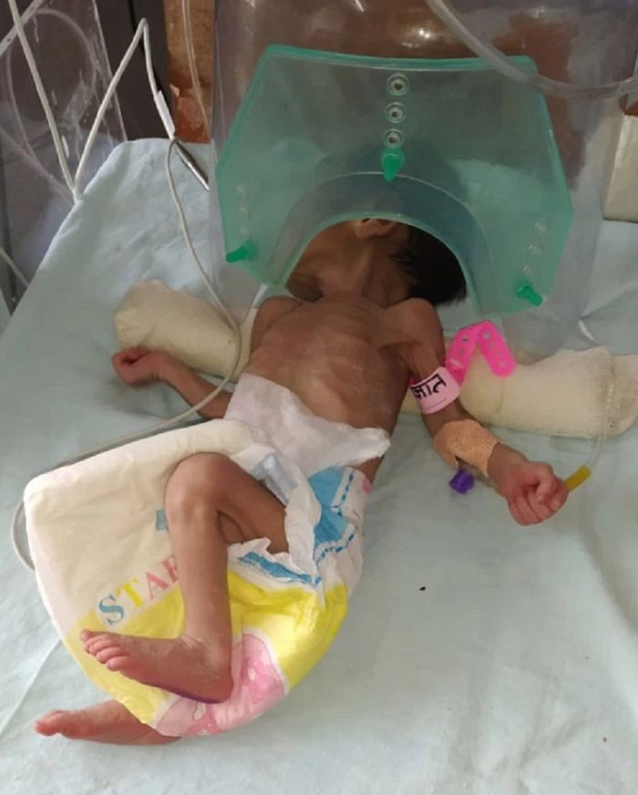 Berumur 3 Hari Bayi Yang Dikubur Hidup Hidup Ini Secara Ajaib Selamat Hirup Oksigen Lewat Tanah Dan Andalkan Lemak Coklat Semua Halaman Intisari