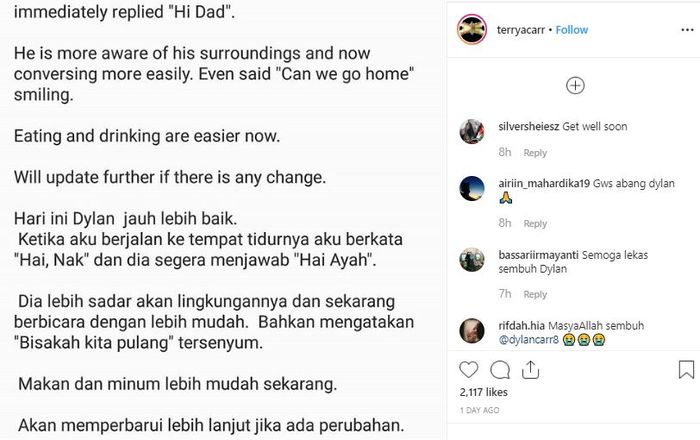 Unggahan keluarga mengenai kondisi Dylan Carr