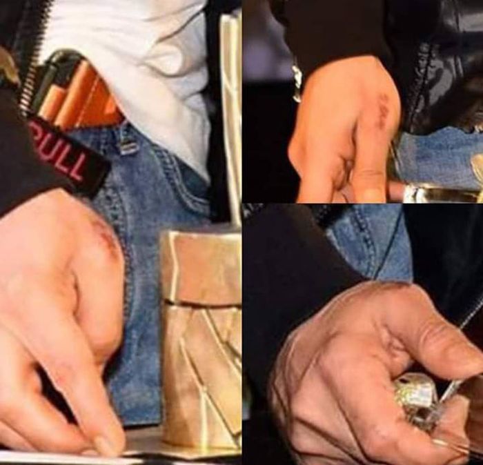 Tangan Shah Rukh Khan yang diduga bekas luka bakar setelah menyelamatkan manajer Aishwarya Rai