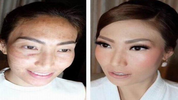 Transformasi kulit wajah Ayu Dewi