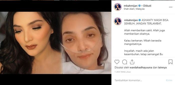 Mbah Mijan peringatkan Ashanty jangan sampai terlambat mengenai kesehatannya