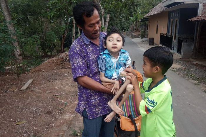 Dimas, anak 12 tahun dengan bobot 10 kg