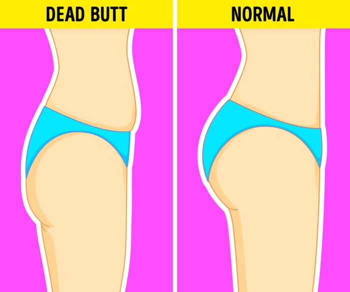 Perhatikan Bentuk Pantat Anda 4 Perbedaan Bentuk Pantat Ini Ternyata Bisa Memberi Tahu Kondisi Kesehatan Kita Semua Halaman Intisari