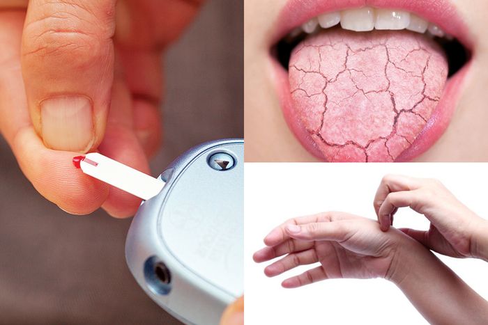 diabetes fasal sha7n diabetes fasal sha7n
