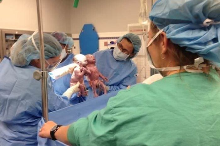 Bayi bergandengan tangan