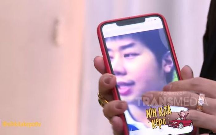 Wajah Roy Kiyoshi yang tampak gemuk sebelum operasi