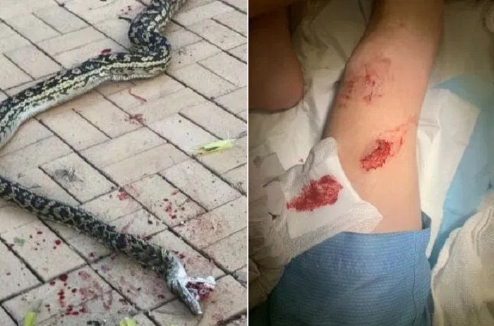 Kondisi kaki Clifford saat digigit