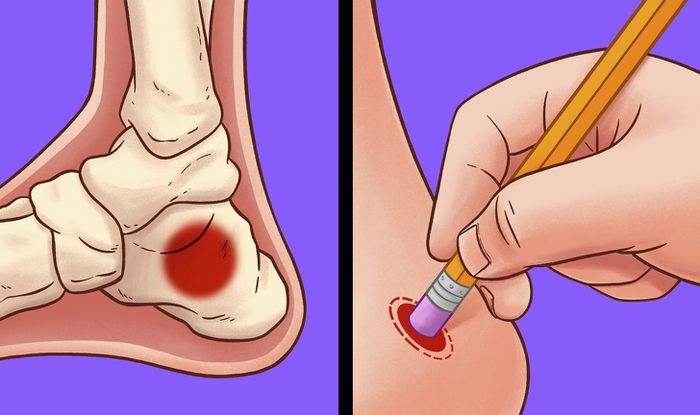 Kaki Terasa Pegal Lakukan Ini Untuk Atasi Kaki Lelah Dan Pegal