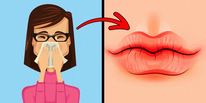 ibir kering dan pecah-pecah