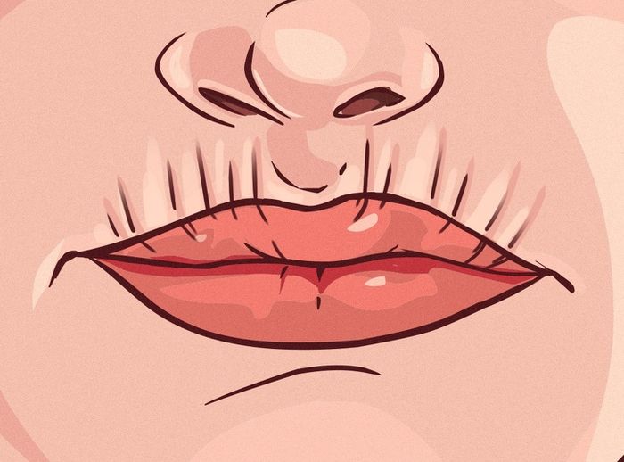 Kerutan di bibir atas