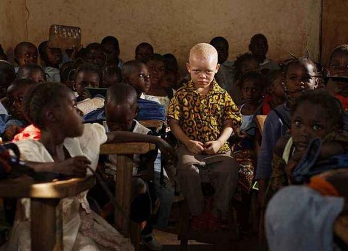 Anak-anak kulit putih ini diperlakukan berbeda.