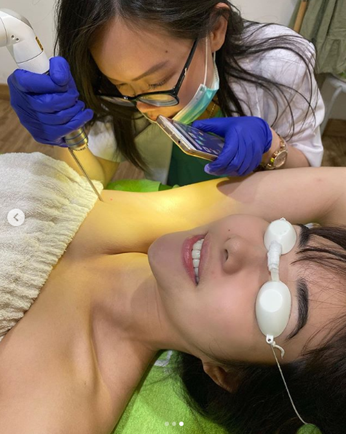 Gisella Anastasia mantan isti Gading Marten saat melakukan tretament hair removal