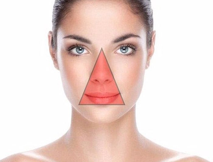 Bahaya Hindari Memencet Jerawat Di Area Segitiga Mematikan Wajah Semua Halaman Stylo